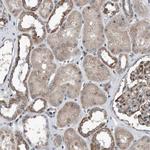 DST Antibody in Immunohistochemistry (Paraffin) (IHC (P))