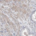 DST Antibody in Immunohistochemistry (Paraffin) (IHC (P))