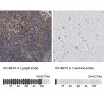 PSMB10 Antibody in Immunohistochemistry (IHC)