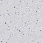 PSMB10 Antibody in Immunohistochemistry (IHC)