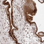 DACT2 Antibody in Immunohistochemistry (Paraffin) (IHC (P))