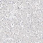 ITPKB Antibody in Immunohistochemistry (Paraffin) (IHC (P))