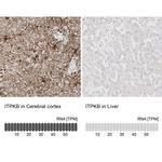 ITPKB Antibody