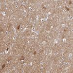 GDA Antibody in Immunohistochemistry (Paraffin) (IHC (P))