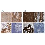 GDA Antibody in Immunohistochemistry (IHC)