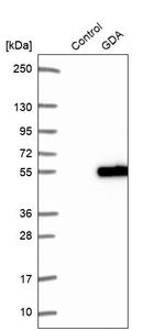 GDA Antibody in Western Blot (WB)