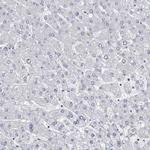 ABCF2 Antibody in Immunohistochemistry (IHC)