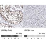 ABCF2 Antibody