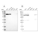 ABCF2 Antibody in Western Blot (WB)