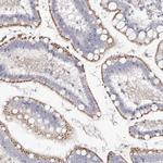 SLC35D3 Antibody in Immunohistochemistry (IHC)