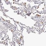 SLC35D3 Antibody in Immunohistochemistry (IHC)