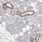 SLC35D3 Antibody in Immunohistochemistry (IHC)