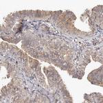 MICAL2 Antibody in Immunohistochemistry (IHC)