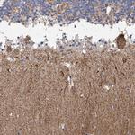 PARD3 Antibody in Immunohistochemistry (IHC)