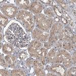 PARD3 Antibody in Immunohistochemistry (IHC)