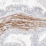 KCNH5 Antibody in Immunohistochemistry (Paraffin) (IHC (P))