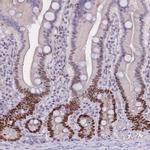 NASP Antibody in Immunohistochemistry (Paraffin) (IHC (P))