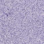 NASP Antibody in Immunohistochemistry (IHC)