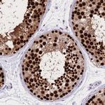 NASP Antibody in Immunohistochemistry (Paraffin) (IHC (P))