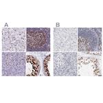 NASP Antibody in Immunohistochemistry (IHC)