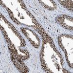 C1orf69 Antibody in Immunohistochemistry (Paraffin) (IHC (P))