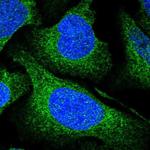 UFL1 Antibody in Immunocytochemistry (ICC/IF)