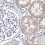 UFL1 Antibody in Immunohistochemistry (IHC)