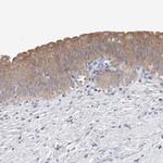 UFL1 Antibody in Immunohistochemistry (IHC)