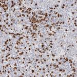 ZNF227 Antibody in Immunohistochemistry (Paraffin) (IHC (P))