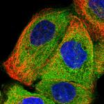 SMAP1 Antibody in Immunocytochemistry (ICC/IF)