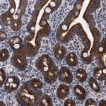 MRPL28 Antibody in Immunohistochemistry (Paraffin) (IHC (P))