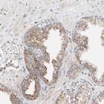 YIPF7 Antibody in Immunohistochemistry (Paraffin) (IHC (P))