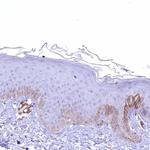 SYNPO2 Antibody in Immunohistochemistry (Paraffin) (IHC (P))