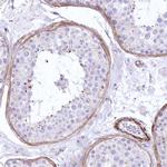 SYNPO2 Antibody in Immunohistochemistry (Paraffin) (IHC (P))