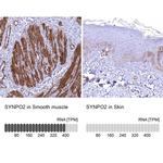 SYNPO2 Antibody in Immunohistochemistry (IHC)