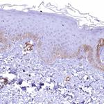 SYNPO2 Antibody in Immunohistochemistry (IHC)