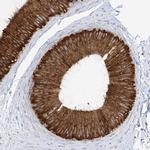 RCN2 Antibody in Immunohistochemistry (Paraffin) (IHC (P))