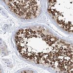 RCN2 Antibody in Immunohistochemistry (Paraffin) (IHC (P))