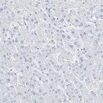 RCN2 Antibody in Immunohistochemistry (Paraffin) (IHC (P))