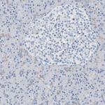 RCN2 Antibody in Immunohistochemistry (IHC)