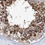 RCN2 Antibody in Immunohistochemistry (IHC)