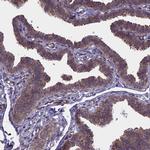 ARD1A Antibody in Immunohistochemistry (IHC)