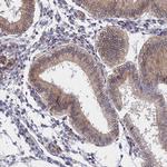 ARD1A Antibody in Immunohistochemistry (IHC)