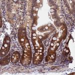 ARD1A Antibody in Immunohistochemistry (IHC)