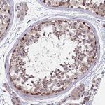 ARD1A Antibody in Immunohistochemistry (IHC)