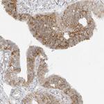 STT3A Antibody in Immunohistochemistry (Paraffin) (IHC (P))