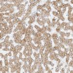 STT3A Antibody in Immunohistochemistry (Paraffin) (IHC (P))