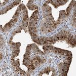 VMP1 Antibody in Immunohistochemistry (Paraffin) (IHC (P))