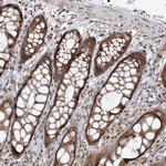 VMP1 Antibody in Immunohistochemistry (Paraffin) (IHC (P))