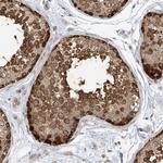 VMP1 Antibody in Immunohistochemistry (Paraffin) (IHC (P))